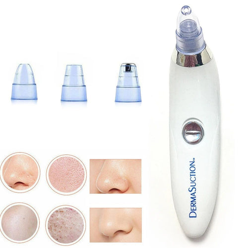 Blackhead Removal Machine Derma Suction 4 in 1